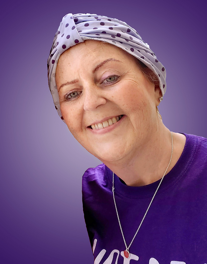 Jo Brooks